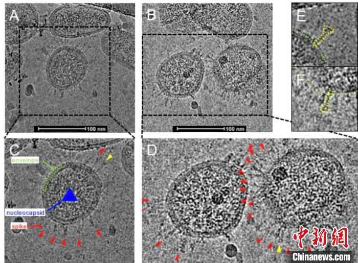 深圳科研团队首次描绘灭活新冠病毒的真实形貌（图）