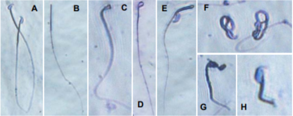 新研究：瑞德西韦小鼠实验中有生殖毒性，严重
