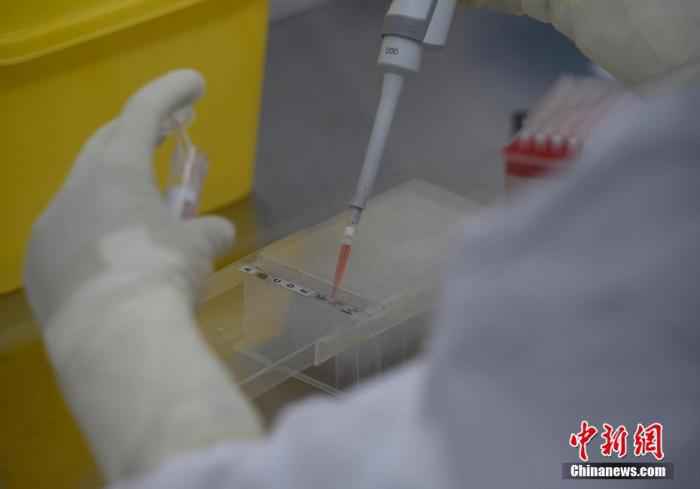 国务院联防联控机制:提高核酸检测能力 推动医