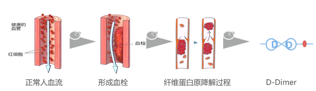 D-二聚体，6大方法方法学，哪个更好？